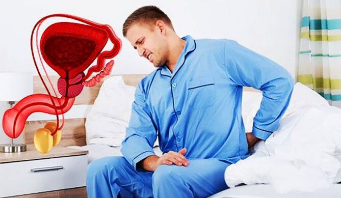 Douleurs lombaires dues à la prostatite