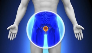 Traitement de la prostatite avec des médicaments