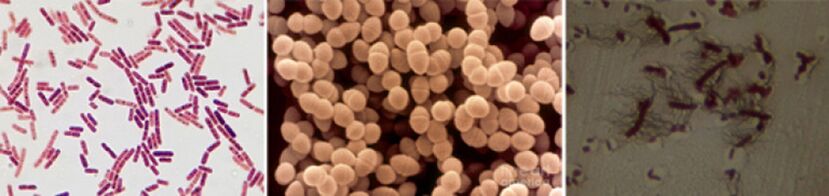 E. coli, les entérocoques fécaux et Proteus sont les principales causes de prostatite bactérienne chronique