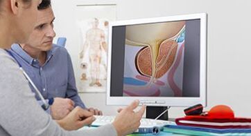Diagnostic de la prostatite chez un homme