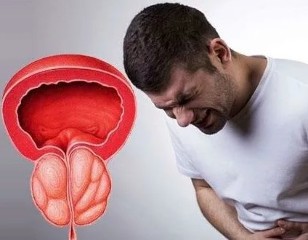 Les symptômes de la prostatite chronique chez les hommes